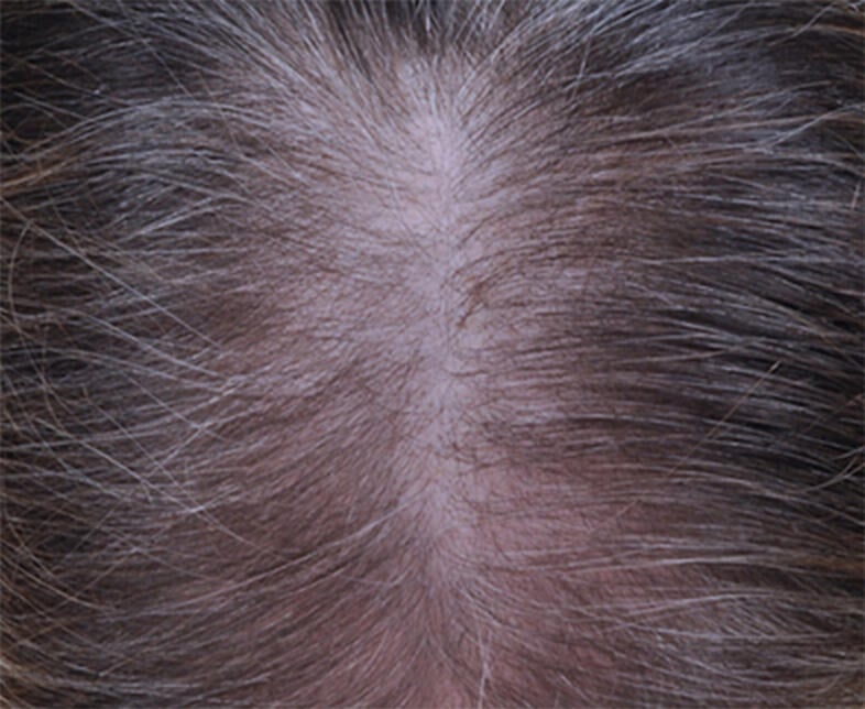 before results image