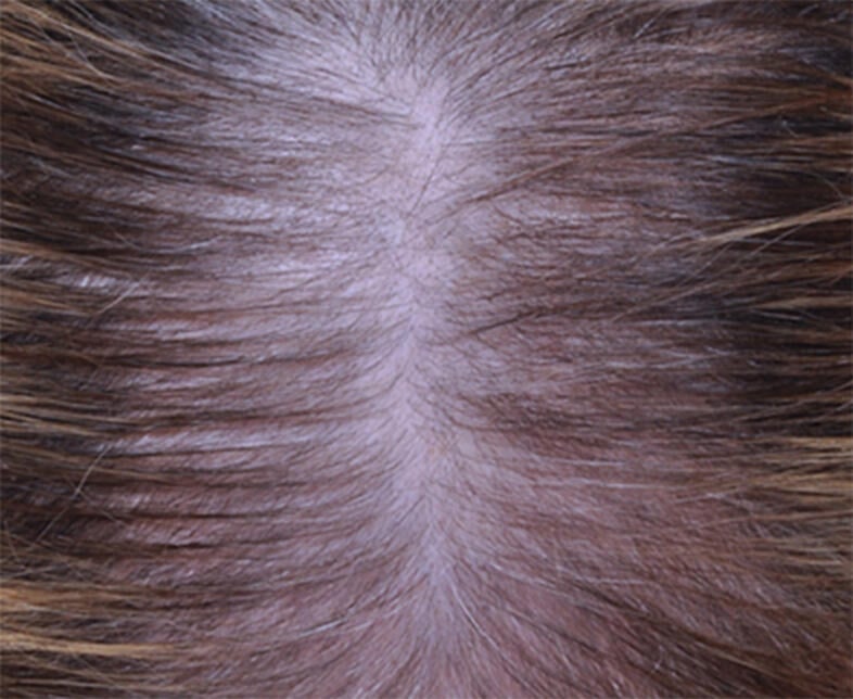 before results image